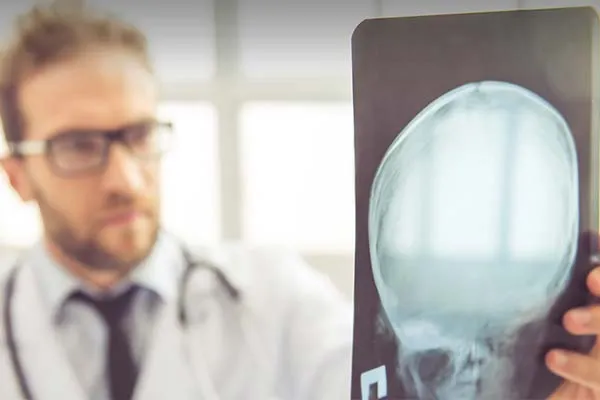 Brain-Injuries-or-Concussions